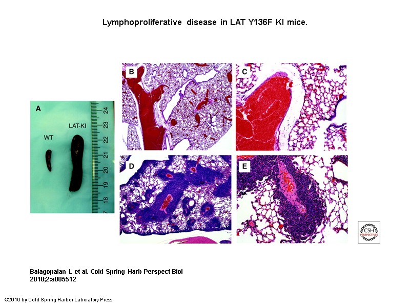 Lymphoproliferative disease in LAT Y136F KI mice. Balagopalan L et al. Cold Spring Harb